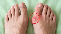 足の骨に「さようなら」を言いましょう：6つのエクササイズで、同時に足をリラックスさせましょう